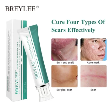 BREYLEE Acne Scar Removal Cream 30 g Obraz, Krema Koža Popravila za Nego Kože, Brazgotine, Akne Zdravljenja Odstranjevanje Strij, Krema za Beljenje