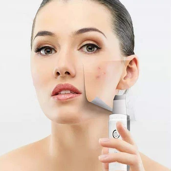 Ultrazvočno Kože Scruber Lušči Extractor Globinsko Čiščenje Obraza Lepota Naprava + Pomlajevanje Kože Nano Obraz Megle Parnik